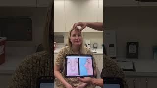 Tip Deformity Corrected  Anthony Bared MD FACS  Miami FL [upl. by Schach787]