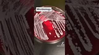 catalase test in microbiology [upl. by Yer]