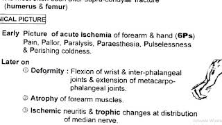 volkman ischemic contracture [upl. by Everara672]