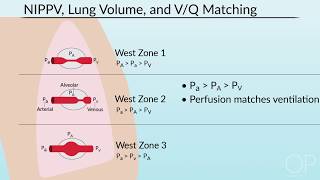 Pulmonary Mechanics in NonInvasive Positive Pressure Ventilation by B McAlvin  OPENPediatrics [upl. by Merlin]