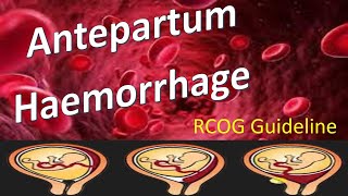 Antepartum Haemorrhage  RCOG Guideline [upl. by Sasnak]