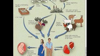 Congenital Toxoplasmosis [upl. by Ecinnahs]