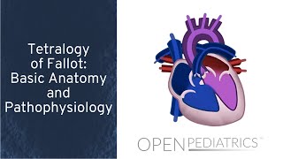 Tetralogy of Fallot Basic Anatomy and Pathophysiology by P Lang L DelSignore  OPENPediatrics [upl. by Nappy]