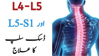 L4L5 L5S1 Disc Slip Treatment  Chiropractic Treatment in Pakistan [upl. by Suhsoj]