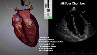 Transesophageal Echocardiography TEE Imaging [upl. by Alleroif709]