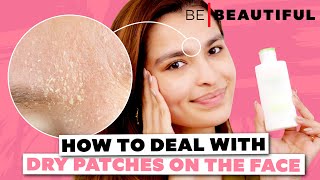 How to Remove Dry Patches From Your Face  Tips to Deal with Dry Skin  Be Beautiful [upl. by Luciano948]