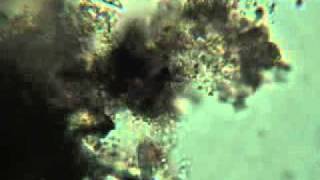 Fish Tank Filter Organisms Under a Microscopeflv [upl. by Damon]