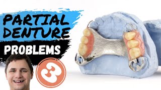 Problems with Partial Dentures  Removable Denture Types [upl. by Petit]