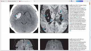 BRAIN DIAGNOSTIC IMAGING SERIES [upl. by Leia734]