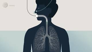 Bronchoscopy  examination of your airways English version [upl. by Airdnek]