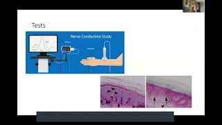 Clinical Manifestations of Neurosarcoidosis  Neurosarcoidosis Patient Day 2023 [upl. by Selry]