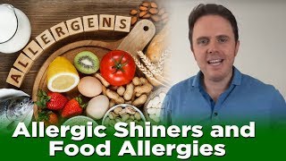 Allergic Shiners and Food Allergies  Dr J Q amp A [upl. by Leiva515]