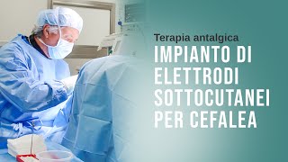 TERAPIA ANTALGICA  Impianto di elettrodi sottocutanei per cefalea [upl. by Anitahs936]