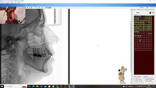 Apresentação Aula Cefalométria Odontológica Computadorizada [upl. by Ihcur]