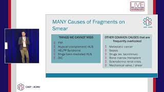 What is Thrombotic Microangiopathy TMA and Why Should I Care [upl. by Schaper]