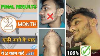 BEARD GROWTH  दाढ़ी आने के बाद ये 2 काम करें □ 2 month done  I got a beard in just 2 months [upl. by Emiolhs]