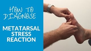 How to diagnose metatarsal stress reaction and fracture [upl. by Tica619]