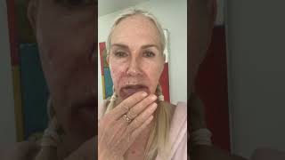 Fluorouracil treatment to lips and face [upl. by Terrene]