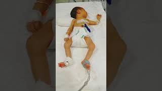 NICU Convulsion of a neonate abnormal movement babyhealth NewbornCare [upl. by Yniatirb938]