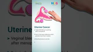 Gynecological Cancer Awareness Month  Dr Nikhil Mehta [upl. by Yekcor917]