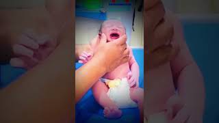 How can we check moro reflex in newborn baby 🍼 cutebaby newbornbaby hospital nicubaby [upl. by Erwin]