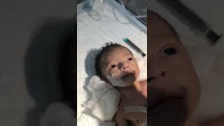 Chestryped for newborn baby😌 sumitnicunursingstm youtubeshorts nursing newbornbaby chestworkout [upl. by Duky]