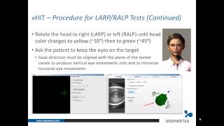 ICS Impulse vHIT Review of test procedures and possible artifacts [upl. by Huggins]