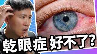 七個真正原因你的乾眼症一直好不了 照做保證迅速獲得改善 [upl. by Sivehc]