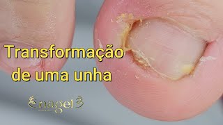 TRANSFORMAÇÃOELE VOLTOU AGORA COM O OUTRO LADO satisfying viral [upl. by Okihcim964]