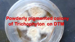 Trichophyton growth on dermatophyte test medium DTM Demo [upl. by Earesed]