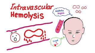 Hemolytic Anemia  Hematology  Part 2🩺 [upl. by Ennairrek]