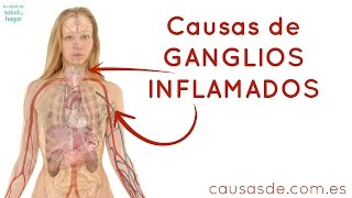 Causas de ganglios inflamados [upl. by Ahsirtal718]