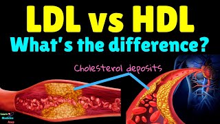 What’s the difference between LDL and HDL – LDL vs HDL  Bad Cholesterol vs Good Cholesterol [upl. by Zuliram]