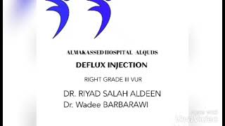 Deflux Injection [upl. by Antoinetta321]