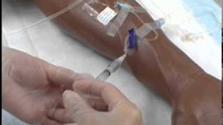 Intravenous IV Therapy Administering IV Medication via a Saline Lock [upl. by Dinsdale]