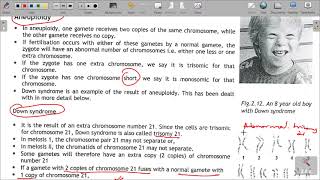 GRADE 12 LIFE SCIENCES CONSEQUENCES OF NON DISJUNCTION OF CHROMOSOMES  ABNORMAL MEIOSIS [upl. by Lehcem]