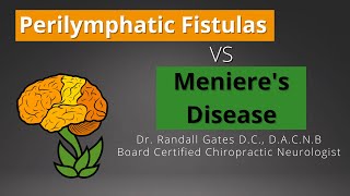 Perilymphatic Fistulas vs Menieres Disease [upl. by Barabbas]