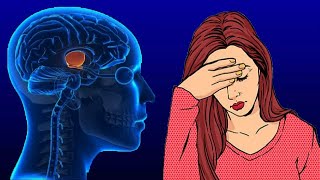 Pituitary Gland Disorders Symptoms And Treatment [upl. by Housen340]