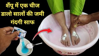 गर्दन हाथ पैर की सालों पुरानी जमी मैल को साफ कर गोरा कर देगी  Dark Neck Hand amp Feet Whitening [upl. by Ecirrehs]