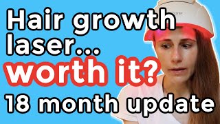 iRestore hair growth laser 18 month update Is it worth it Dr Dray [upl. by Canty392]