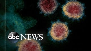 Case of ‘community spread’ of coronavirus in US raises concerns  WNT [upl. by Enaujed266]