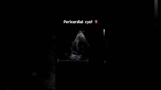 A pericardial cyst in echocardiography 💖 [upl. by Casteel800]