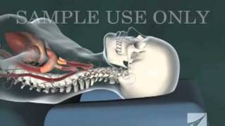 Cervical Chiropractic Adjustment [upl. by Bum418]