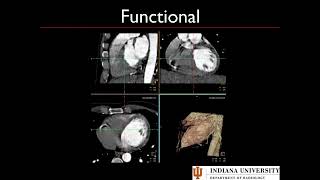 Post Processing Cardiac CT [upl. by Sikras227]