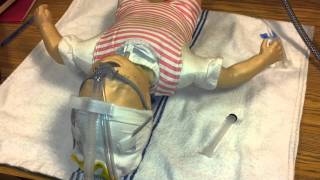 Nasal CPAP  Infant Flow [upl. by Ydieh]