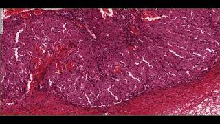 Histology of the Corpus Luteum 4K [upl. by Ecniuq]