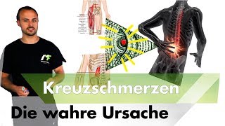 Die wahre Ursache für Schmerzen im unteren Rücken mit Kundengeschichte [upl. by Spencer610]