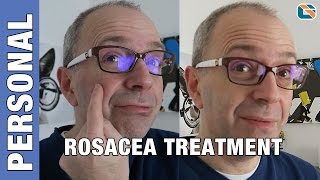 Rosacea Mirvaso Gel Cream Treatment Test  Geek Vlog 376 Rosacea [upl. by Nodal]