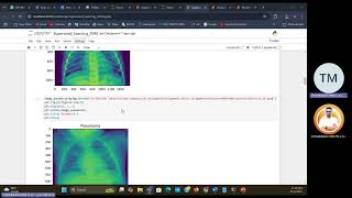 Chest XRay Pneumonia Project using Machine Learning Algorithms [upl. by Lorelie]