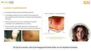 Painehaavat Moduuli 7 – 15 minuutin versio  Wound Club Online [upl. by Vasilis]